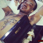 tommy-lee-hospitalized nov 2013